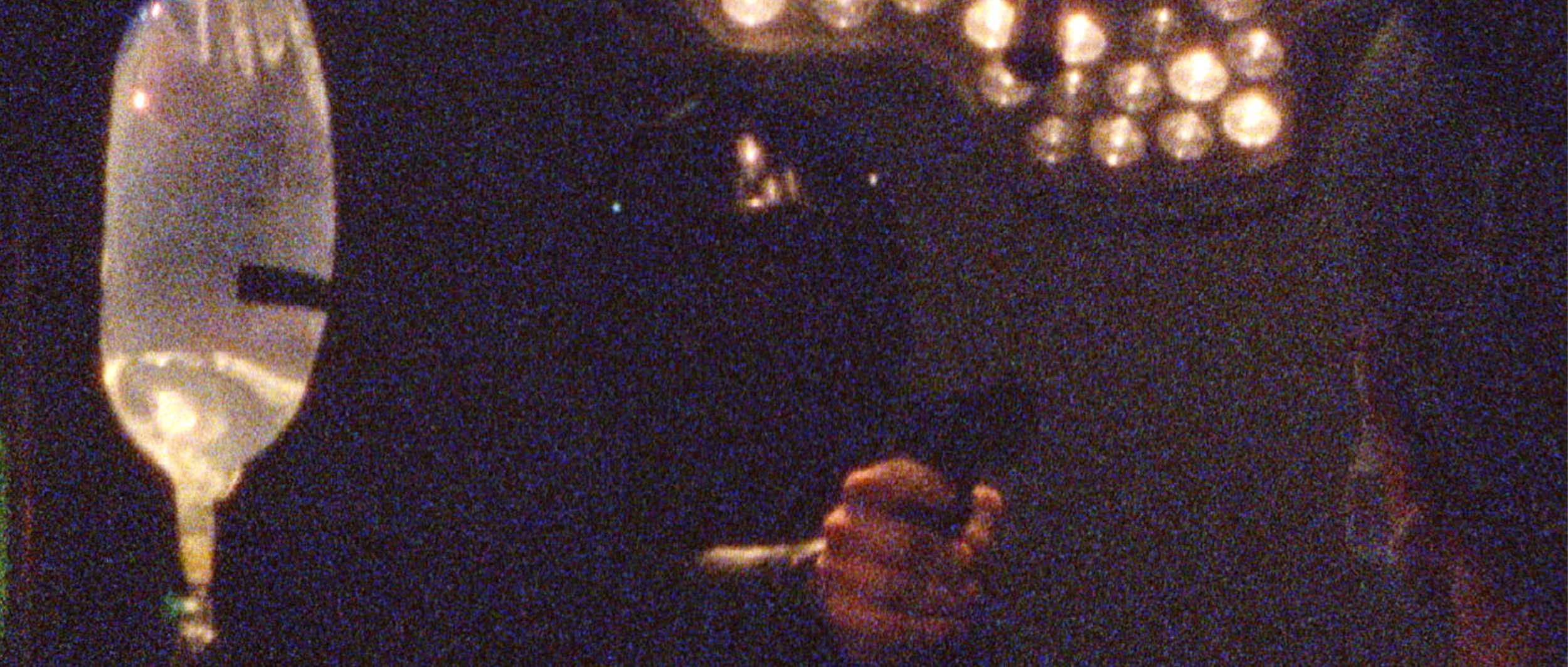 Organ Failure Banner Image